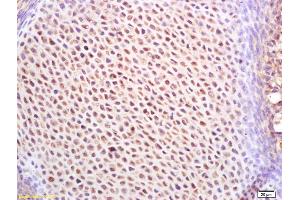 Immunohistochemistry (IHC) image for anti-Insulin-Like Growth Factor 2 mRNA Binding Protein 1 (IGF2BP1) (AA 31-130) antibody (ABIN1386018)