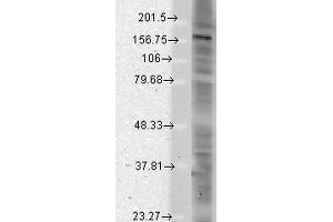 Western Blotting (WB) image for anti-SH3 and Multiple Ankyrin Repeat Domains 2 (SHANK2) (AA 84-309) antibody (Atto 594) (ABIN2484042)