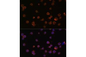Immunofluorescence analysis of THP-1 cells using CTGF antibody (ABIN6127716, ABIN6139187, ABIN6139190 and ABIN6215053) at dilution of 1:100. (CTGF Antikörper  (AA 27-349))