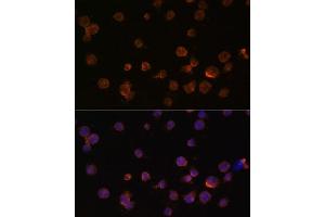 Immunofluorescence analysis of THP-1 cells using CTGF antibody (ABIN6127716, ABIN6139187, ABIN6139190 and ABIN6215053) at dilution of 1:100.