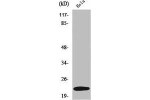 Western Blot analysis of K562 cells using UBE2T Polyclonal Antibody