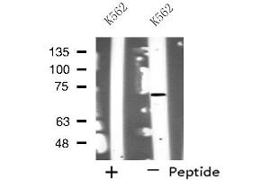 Western blot analysis of extracts from K562 cells, using NOLC1 antibody. (NOLC1 Antikörper  (C-Term))