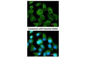 ICC/IF Image Immunofluorescence analysis of methanol-fixed A431, using TPP1, antibody at 1:200 dilution. (TPP1 Antikörper)