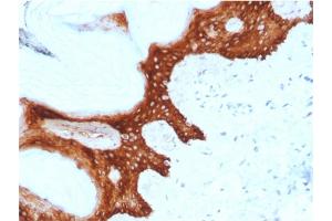 Formalin-fixed, paraffin-embedded human Skin stained with Stratifin Mouse Monoclonal Antibody (CPTC-SFN-2). (14-3-3 sigma/SFN Antikörper)