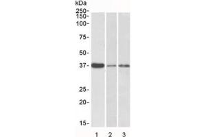 Western blot testing of human 1) liver, 2) skin and 3) tonsil lysate with IL12B antibody at 0. (IL12B Antikörper)