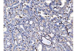 IHC analysis of EVL using anti-EVL antibody (ABIN7600986). (EVL Antikörper  (AA 268-400))