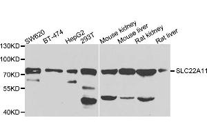 Western blot analysis of extracts of various cells, using SLC22A11 antibody. (SLC22A11 Antikörper)