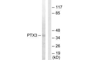 Western blot analysis of extracts from 293 cells, using PTX3 antibody. (PTX3 Antikörper  (N-Term))