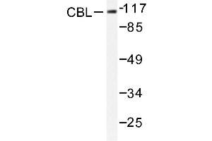 Image no. 1 for anti-Cas-Br-M (Murine) Ecotropic Retroviral Transforming Sequence (CBL) antibody (ABIN272004) (CBL Antikörper)