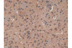 IHC-P analysis of Mouse Brain Tissue, with DAB staining. (MAP1A Antikörper  (AA 2552-2759))