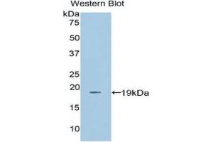 Western Blotting (WB) image for anti-Farnesyl-Diphosphate Farnesyltransferase 1 (FDFT1) (AA 269-417) antibody (ABIN3206188) (FDFT1 Antikörper  (AA 269-417))