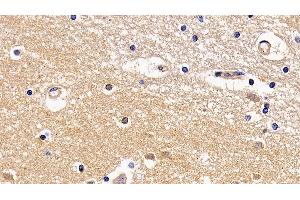 Detection of TMPRSS2 in Human Cerebrum Tissue using Polyclonal Antibody to Transmembrane Protease, Serine 2 (TMPRSS2)