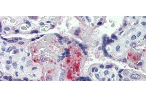 Immunohistochemistry (IHC) image for anti-Coagulation Factor II (thrombin) (F2) (Middle Region) antibody (ABIN2776976)