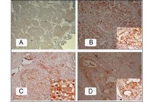 Immunohistochemistry (IHC) image for anti-Folate Hydrolase (Prostate-Specific Membrane Antigen) 1 (FOLH1) antibody (ABIN452578) (PSMA Antikörper)