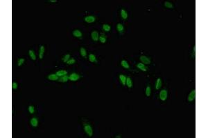 Immunofluorescent analysis of Hela cells using ABIN7165672 at dilution of 1:100 and Alexa Fluor 488-congugated AffiniPure Goat Anti-Rabbit IgG(H+L) (JARID2 Antikörper  (AA 1-159))