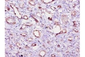 Immunohistochemistry (IHC) image for anti-Eukaryotic Translation Initiation Factor 4E Binding Protein 2 (EIF4EBP2) (AA 1-120) antibody (ABIN7152198)