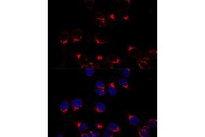 Confocal immunofluorescence analysis of Hela cells using USO1 antibody (ABIN7271235) at dilution of 1:200. (USO1 Antikörper  (AA 663-962))