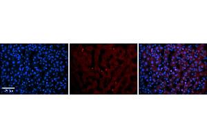 Rabbit Anti-TEAD4 Antibody    Formalin Fixed Paraffin Embedded Tissue: Human Adult liver  Observed Staining: Nuclear in endothelial cells not in hepatocytes Primary Antibody Concentration: 1:600 Secondary Antibody: Donkey anti-Rabbit-Cy2/3 Secondary Antibody Concentration: 1:200 Magnification: 20X Exposure Time: 0. (TEAD4 Antikörper  (N-Term))