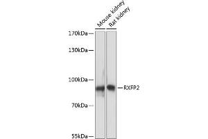 Western blot analysis of extracts of various cell lines, using RXFP2 antibody (ABIN7269908) at 1:3000 dilution. (RXFP2 Antikörper  (AA 80-180))