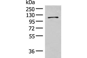 Western blot analysis of Hela cell lysate using FANCB Polyclonal Antibody at dilution of 1:550 (FANCB Antikörper)