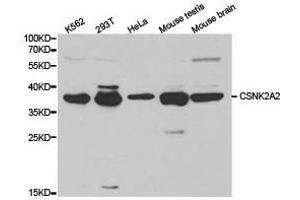 Western Blotting (WB) image for anti-Casein Kinase 2, alpha Prime Polypeptide (CSNK2A2) antibody (ABIN1872040)
