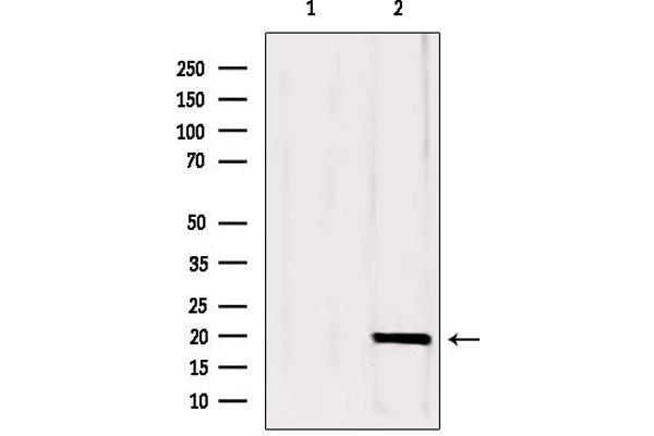 Complexin 1 Antikörper  (N-Term)