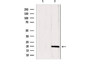Western blot analysis of extracts from mouse brain, using CPLX1 antibody. (Complexin 1 Antikörper  (N-Term))