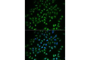 Immunofluorescence analysis of A549 cell using HAND2 antibody.