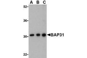 Western blot analysis of BAP31 in Ramos cell lysate with AP30123PU-N BAP31 antibody at (A) 0. (BCAP31 Antikörper  (C-Term))