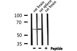 Western Blotting (WB) image for anti-Protein Phosphatase 2, Regulatory Subunit B' alpha (PPP2R5A) (Internal Region) antibody (ABIN6259159)
