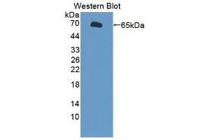 Detection of Recombinant TAT1, Human using Polyclonal Antibody to Testis Anion Transporter 1 (TAT1) (SLC26A8 Antikörper  (AA 664-970))