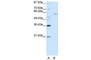 WB Suggested Anti-RCOR1  Antibody Titration: 0. (CoREST Antikörper  (C-Term))