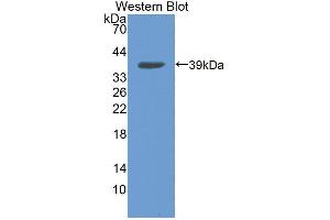 Western blot analysis of the recombinant protein. (NCOA3 Antikörper  (AA 1-269))