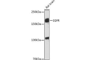 Western blot analysis of extracts of Rat brain, using EGFR antibody (ABIN6133681, ABIN6139977, ABIN6139982 and ABIN6219256) at 1:1000 dilution. (EGFR Antikörper  (AA 1100-1200))