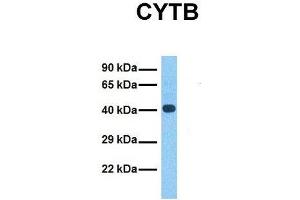 Host:  Rabbit  Target Name:  CYTB  Sample Tissue:  Human Fetal Liver  Antibody Dilution:  1.