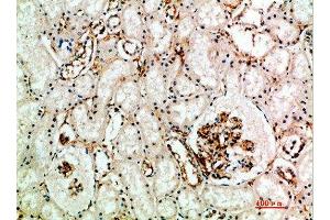 Immunohistochemical analysis of paraffin-embedded human-kidney, antibody was diluted at 1:200 (Endoglin Antikörper  (AA 370-430))