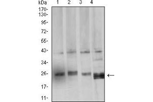 Western Blotting (WB) image for anti-BCL2-Like 2 (BCL2L2) (AA 6-118) antibody (ABIN5611241)