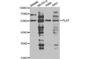 Western blot analysis of extracts of various cell lines, using PLAT antibody (ABIN5973300) at 1/1000 dilution. (PLAT Antikörper)