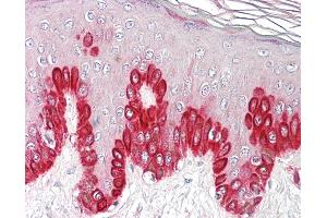 Anti-SIRT1 antibody IHC of human skin. (SIRT1 Antikörper  (AA 577-590))