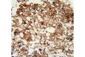 Immunohistochemistry (IHC) image for anti-Integrin alpha M (ITGAM) (AA 253-282) antibody (ABIN3031364)