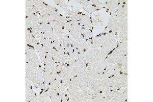 Immunohistochemistry (Paraffin-embedded Sections) (IHC (p)) image for anti-Histone Cluster 1, H2ag (HIST1H2AG) antibody (ABIN3068853)