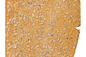 ABIN6258684 and ABIN6274829 at 1/100 staining Rat brain tissue by IHC-P. (AKR1E2 Antikörper  (Internal Region))