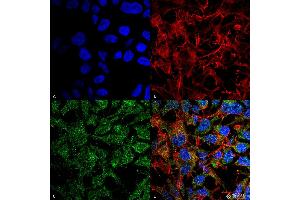 Immunocytochemistry/Immunofluorescence analysis using Rabbit Anti-BDNF Polyclonal Antibody . (BDNF Antikörper  (N-Term) (APC))
