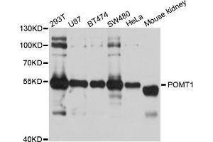 Western blot analysis of extracts of various cell lines, using POMT1 antibody (ABIN5998570) at 1/1000 dilution. (POMT1 Antikörper)