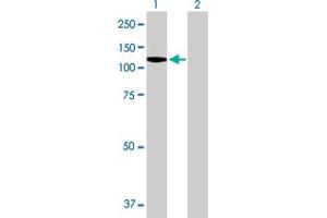 Western Blot analysis of DDX11 expression in transfected 293T cell line by DDX11 MaxPab polyclonal antibody. (DDX11 Antikörper  (AA 1-970))
