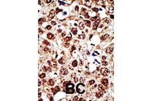 Immunohistochemistry (Paraffin-embedded Sections) (IHC (p)) image for anti-Farnesyl-Diphosphate Farnesyltransferase 1 (FDFT1) (AA 140-170) antibody (ABIN389052)