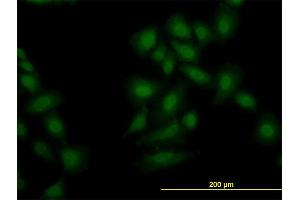 Immunofluorescence of monoclonal antibody to OXSR1 on HeLa cell. (OXSR1 Antikörper  (AA 1-527))