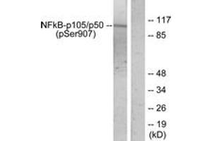 Western blot analysis of extracts from HeLa cells treated with TNF-alpha, using NF-kappaB p105/p50 (Phospho-Ser907) Antibody. (NFKB1 Antikörper  (pSer907))