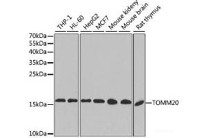 Western blot analysis of extracts of various cell lines, using TOMM20 antibody.