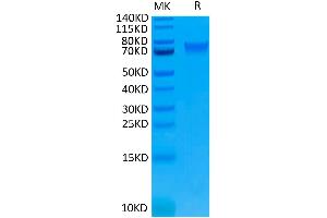 Biotinylated Human IL-6 R alpha on Tris-Bis PAGE under reduced condition. (IL6RA Protein (His-Avi Tag,Biotin))